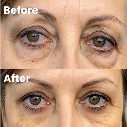 GlowLuxe® 2-in-1 Red Light + EMS To Erase Eye Bags