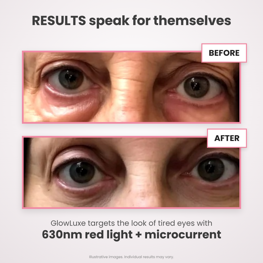 GlowLuxe® 2-in-1 Red Light + EMS To Erase Eye Bags